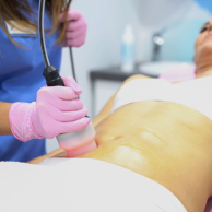 Cryotherapy